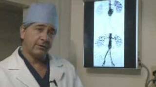 Abdominal Aortic Aneurysm Repair [upl. by Redle]