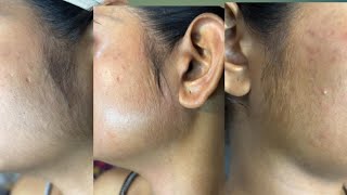 Face waxing tips for beginnersHow to do sidelocks waxing skincare sidelockswax​⁠ ​⁠ [upl. by Eicats551]