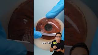 Corrigindo Miopia 👨‍⚕️👓 medicina medico oftalmologia curiosidades curiosidademedicina saude [upl. by Ck589]