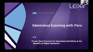 Preview Elevating Digital Impressions Edentulous Scanning with iTero [upl. by Milinda]