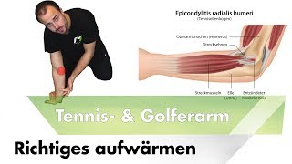 Vor dem Dehnen aufwärmen  Tennis amp Golferellenbogen [upl. by Brenner362]