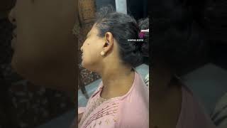 Skin Maruva easya remove pannalam shortstamil hairstyle [upl. by Armallas]