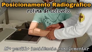 Rotina de cotovelo APperfilincidência complementar Posicionamento radiográfico [upl. by Yelich]