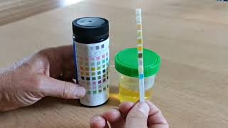 How to use urine test strips 10 parameters [upl. by Yniatirb131]