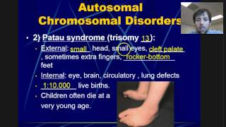 Chromosomal Disorders [upl. by Averil719]