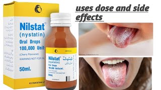 nilstat dropsNystatinuses dose and side effects [upl. by Aisad]