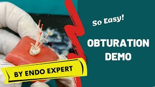 Obturation Made Easy ENDODONTICS DEMO [upl. by Retsim]