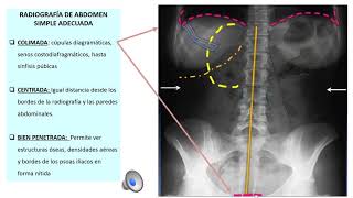 RADIOGRAFIA ABDOMEN [upl. by Audwin590]