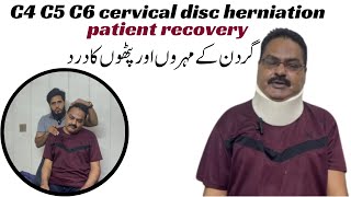 C4C5C6 Cervical Disc Herniation Quick Patient recovery physioshubb [upl. by Ludlew]