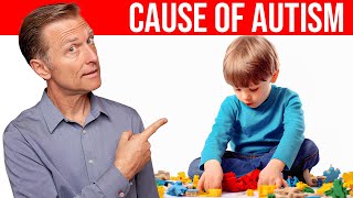 The REAL Cause of Autism Revealed Dr Berg Explains [upl. by Quartis]