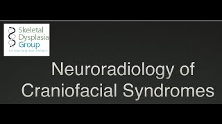 Neuroradiology of Craniofacial Syndromes craniosynostosis and beyond [upl. by Jennings]