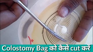 How to cut colostomy Bag in Hindi  How to change colostomy bag in Hindi  Jaichand Rajasthani [upl. by Assenat]