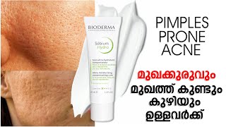 മുഖത്ത് കുണ്ടും കുഴിയും ഉള്ളവർക്ക്  Bioderma Sebium Hydra For Acne Prone Skin [upl. by Luahs]