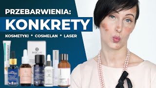 KONKRETY o PRZEBARWIENIACH Lista skutecznych kosmetyków  Cosmelan  laser na przebarwienia [upl. by Darreg]