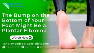 The Bump on the Bottom of Your Foot Might Be a Plantar Fibroma [upl. by Ok791]