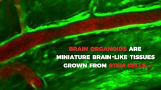 Brain Organoids As Models for Neurological Disorders [upl. by Emmet]