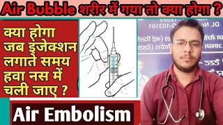 Air Embolism treatment  जब एयर बबल्स हवा नस के अंदर चली जाए तो तब क्या होगा [upl. by Jeraldine]