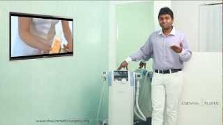 Best Nonsurgical skin tightening and body contouring machine now at Chennai Plastic Surgery [upl. by Atiugal]