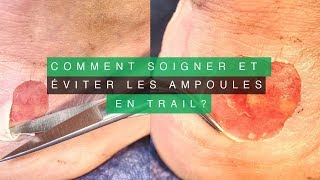 COMMENT SOIGNER ET ÉVITER LES AMPOULES OU PHLYCTÈNES EN TRAIL ❓ [upl. by Strepphon17]