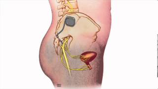 Fecal Incontinence  Heidi Chua MD  Mayo Clinic [upl. by Kajdan]