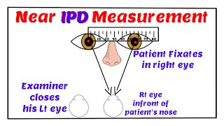 Near Inter Pupillary Distance Measurement [upl. by Anesor]