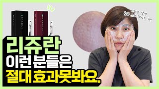 이런 분들은 리쥬란힐러 절대 효과 못 봅니다  셀프시술후기 통증 효과 [upl. by Cicily]