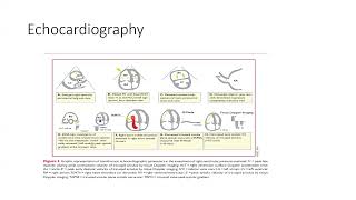 Pulmonary Embolism [upl. by Patnode]