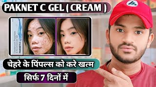 Paknet c gel uses dose benefits and Side effects full review in hindi [upl. by Grous]