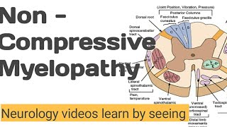 NON Compressive myelopathy  Neurology videos learn by seeing [upl. by Ronal]