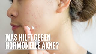 Was hilft gegen hormonelle Akne [upl. by Nimaynib854]