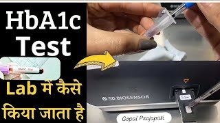 HbA1c test full procedureHbA1c test कैसे किया जाता हैं HbA1c test by SD BIOSENSER f200 Dr Gopal [upl. by Llenet]