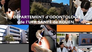 Présentation du département dodontologie de lUFR Santé de Rouen rouen odontologie santé [upl. by Phebe]