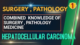 SURGERY 01  HEPATOCELLULAR CARCINOMA  Malignant Tumor of Liver PATHOLOGY LECTURE SURGERY LECTURE [upl. by Enelkcaj]