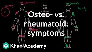 Osteoarthritis vs rheumatoid arthritis symptoms  NCLEXRN  Khan Academy [upl. by Earised471]