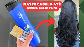 😱SEU CABELO VAI CRESCER EM VELOCIDADE DE FOGUETE  COLOQUE ISSO NO SHAMPOO [upl. by Hsaka]