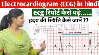 ECG test रिपोर्ट कैसे पढ़ें  What is ECG report in hindi  electrocardiogram report kaise padhen [upl. by Ottavia]