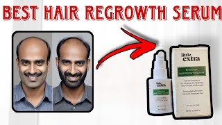 Little Extra Hair Regrowth Serum Review Ghane Baalon ka Raaz 💆‍♀️ hair regrowth littleextraserum [upl. by Nageek]