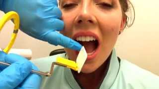 How to Take Periapical Radiographs [upl. by Aihsenad154]