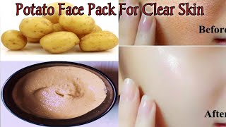 Potato Face Pack For Skin Whitening How to Get Spotless Glowing amp Fair Skin Potato Face Mask [upl. by Hurst149]