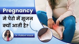 How to Reduce Swelling in Legs During Pregnancy Dr Pallavi Vasal [upl. by Nierman]