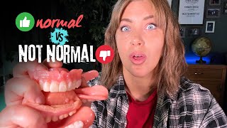 Dentures Whats Normal vs Not Normal [upl. by Annadal]