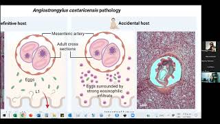 Angiostrongylus costaricensis A 50 años de su descubrimiento [upl. by Nylzzaj]