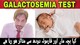 Galactosemia Test  Galactosemia Disease  Galactosemia Kya Hai [upl. by Mufi]