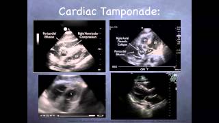 Tutorial Basic echocardiography [upl. by Lindbom]