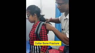 How to wear Clavicle Brace for Collar Clavical Bone Fracture shorts clavicalfracture collarbone [upl. by Eugene596]