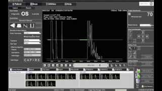 Performing Contact Biometry with the Ellex Eye Cubed [upl. by Ahtibbat]