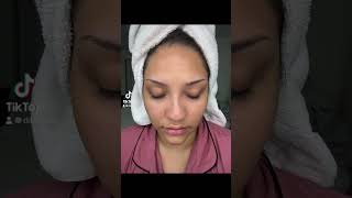 Latisse BEFORE amp AFTER latisse lashes lashgrowth lashextensions fyp serum reel tiktok [upl. by Ozner509]