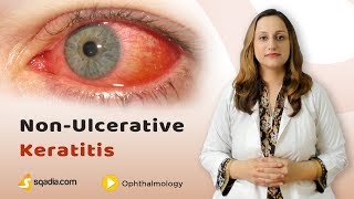 NonUlcerative Keratitis  Ophthalmology Student Lecture  Medical Education  VLearning [upl. by Shaylynn]