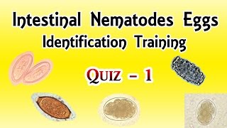 Intestinal Nematodes Eggs Identification Training Quiz 14 [upl. by Kristos115]