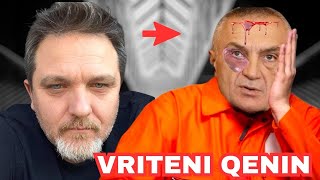 VRITENI QENIN  Jul Deda SULMON Ilir Meten pas Gjendjes se tij te Renduar ne Burg [upl. by Bucella364]